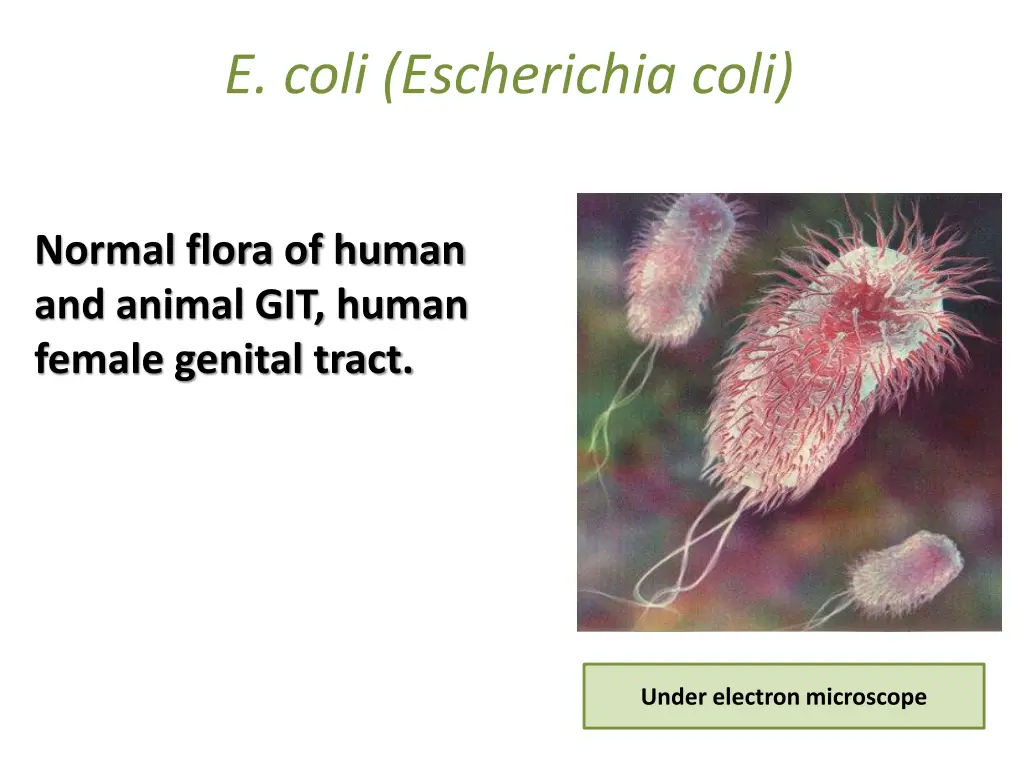 e coli escherichia coli