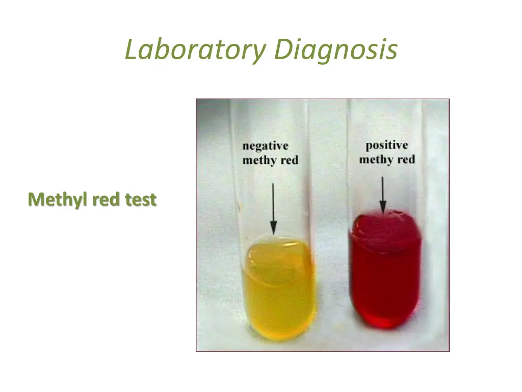 laboratory diagnosis 11