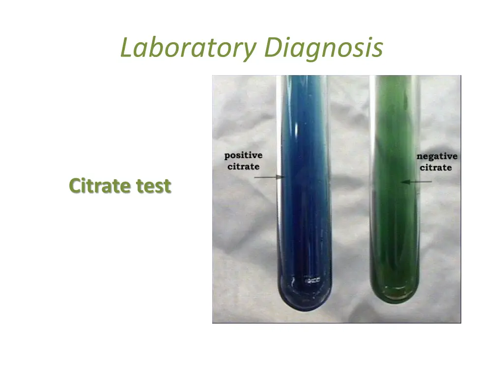 laboratory diagnosis 13