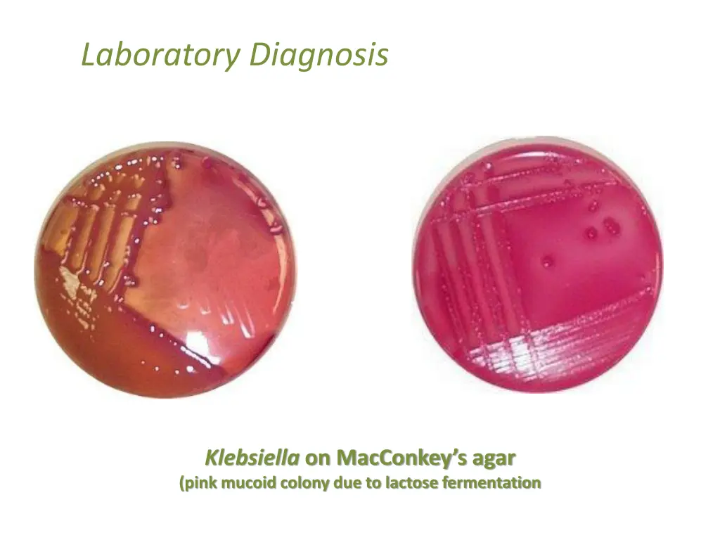 laboratory diagnosis 5