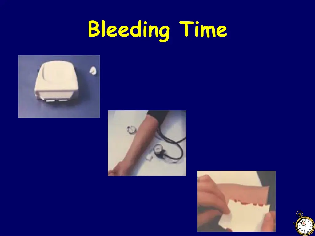 bleeding time