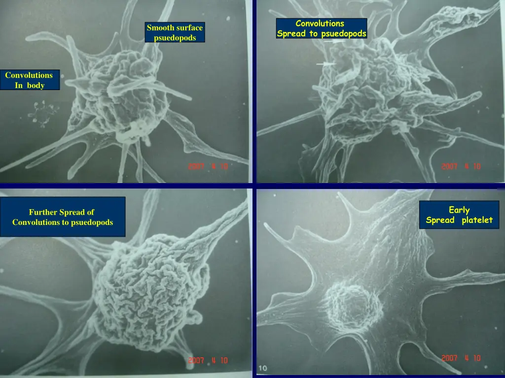 convolutions spread to psuedopods