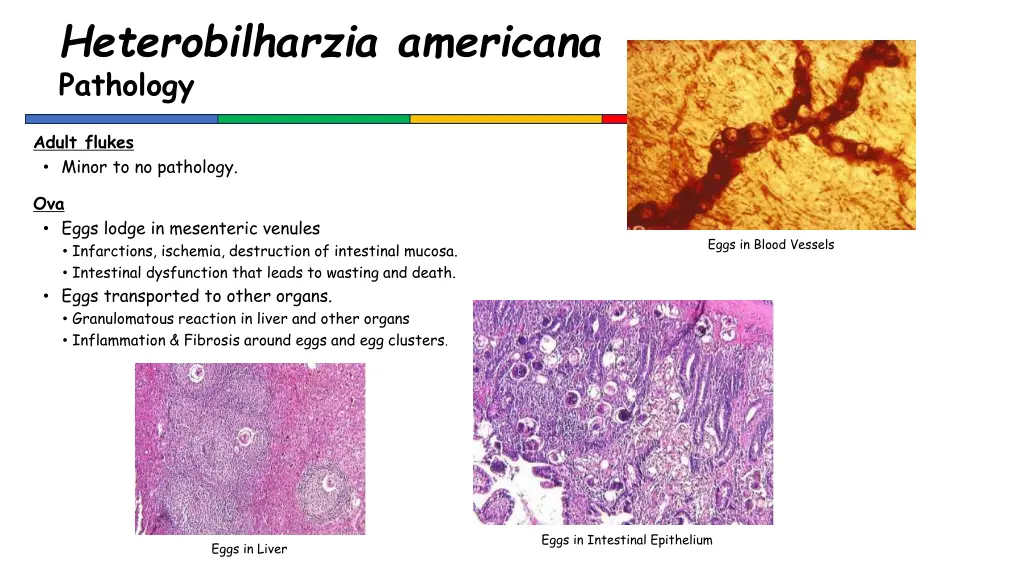 heterobilharzia americana pathology