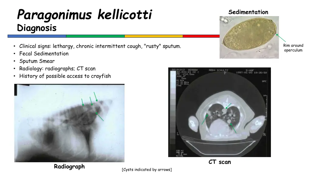 paragonimus kellicotti diagnosis