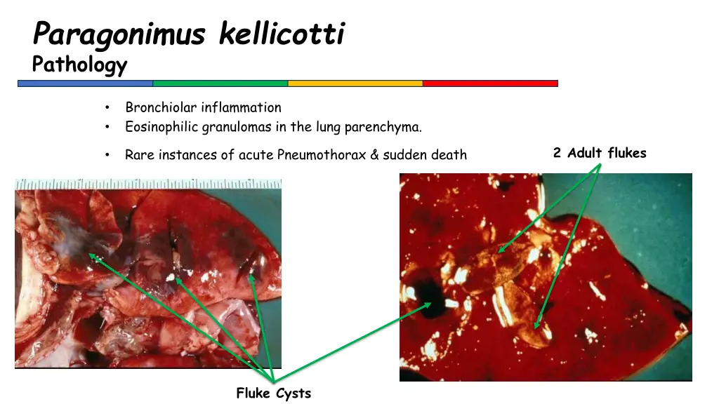 paragonimus kellicotti pathology