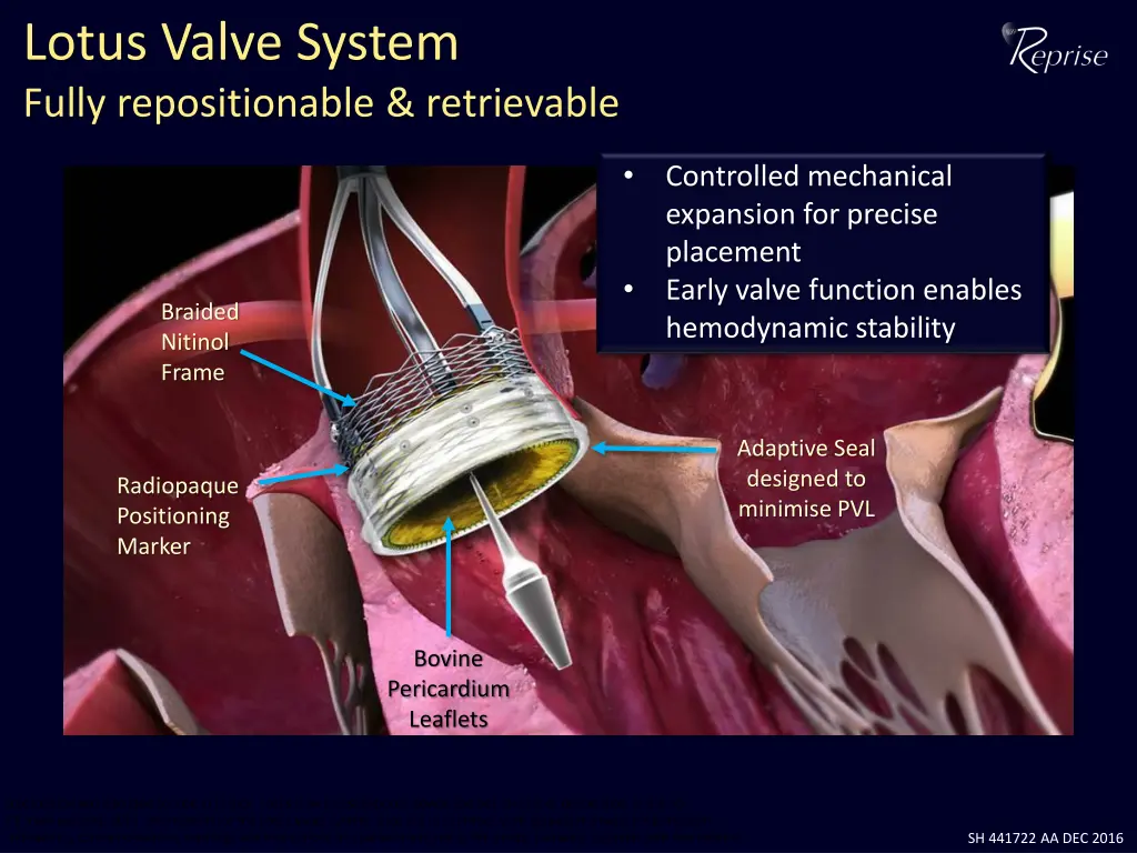 lotus valve system fully repositionable