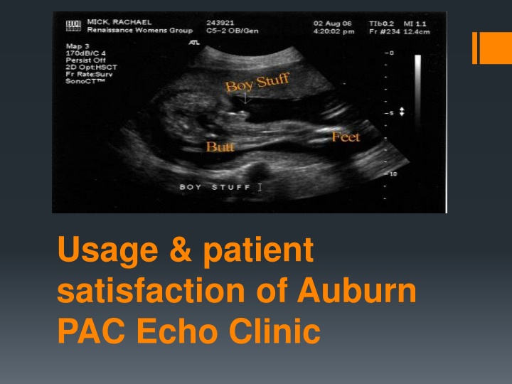 usage patient satisfaction of auburn pac echo