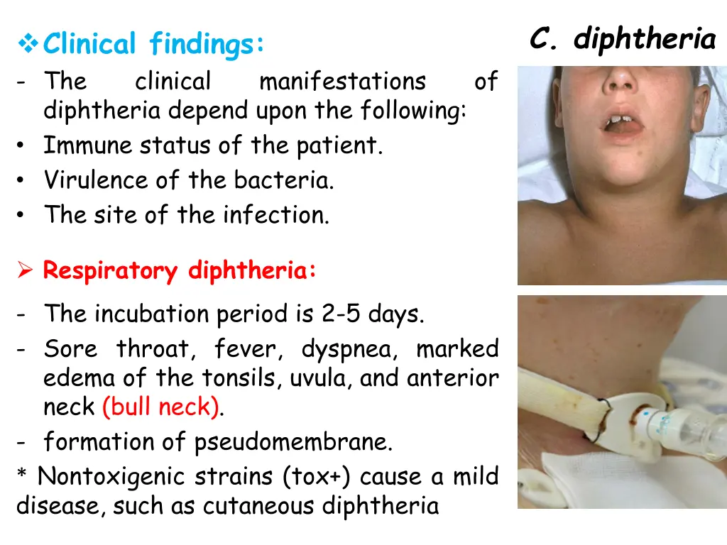 c diphtheria