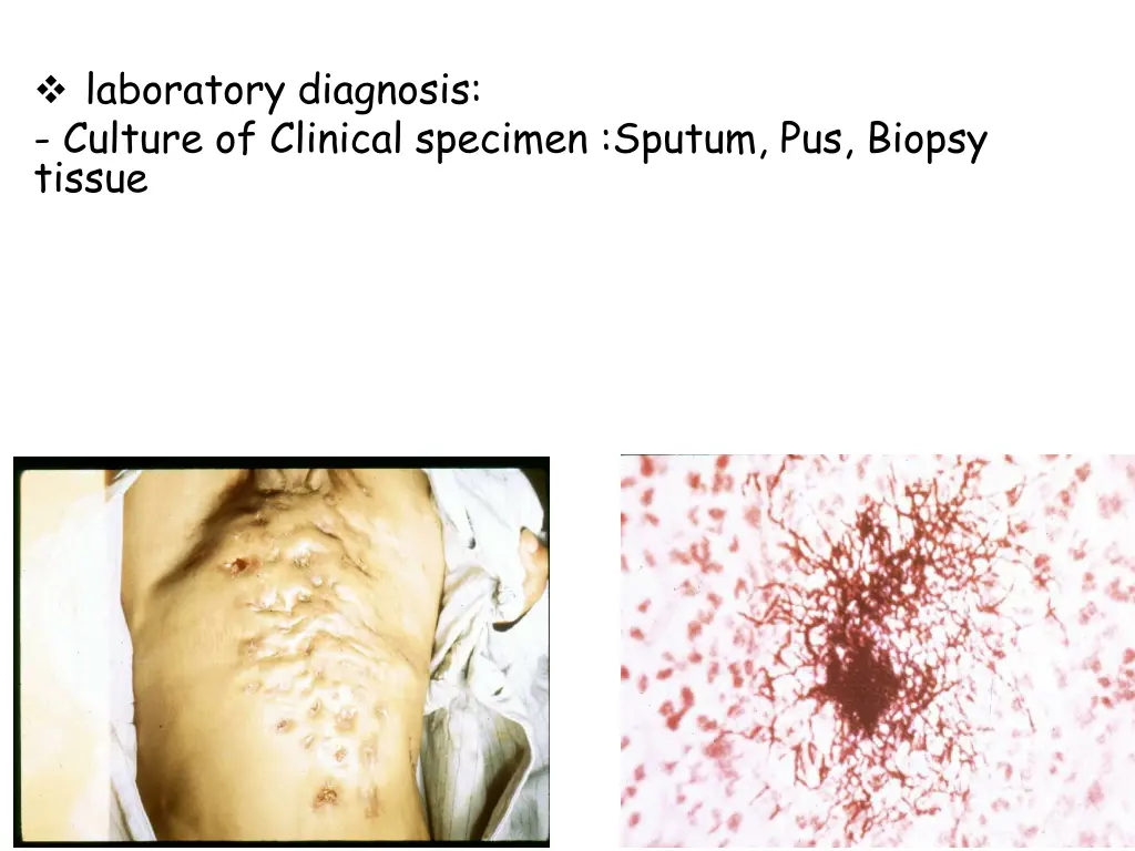 laboratory diagnosis culture of clinical specimen