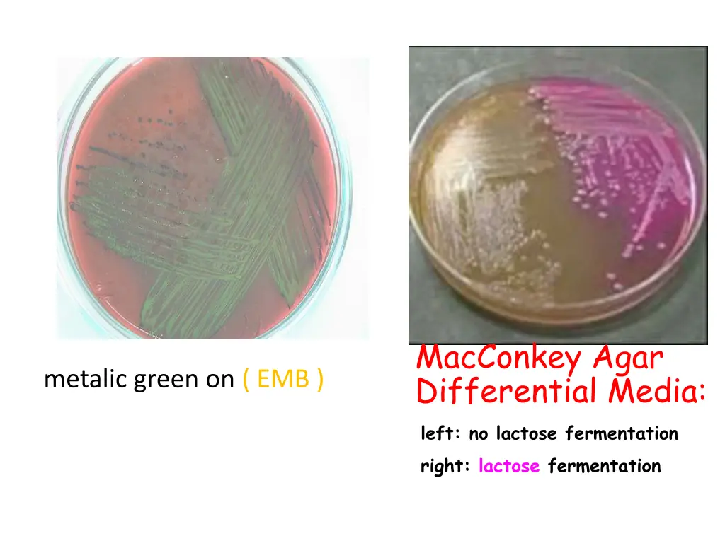 macconkey agar