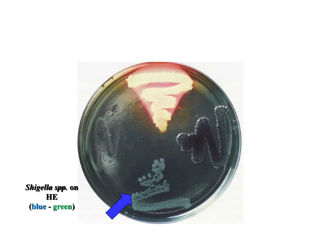 shigella spp on he blue green