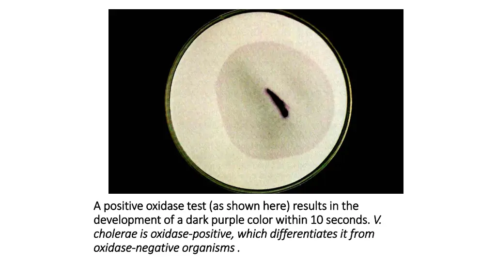 a positive oxidase test as shown here results