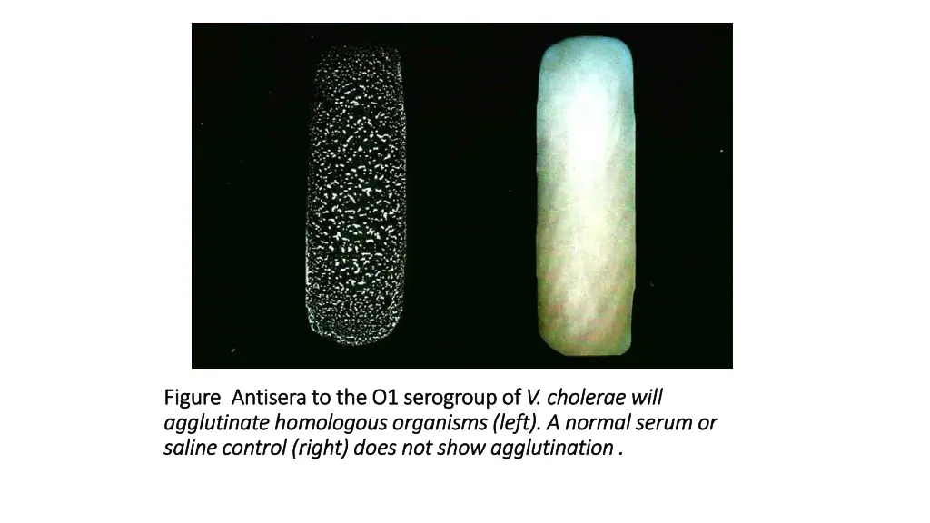 figure antisera to the o1 serogroup of figure