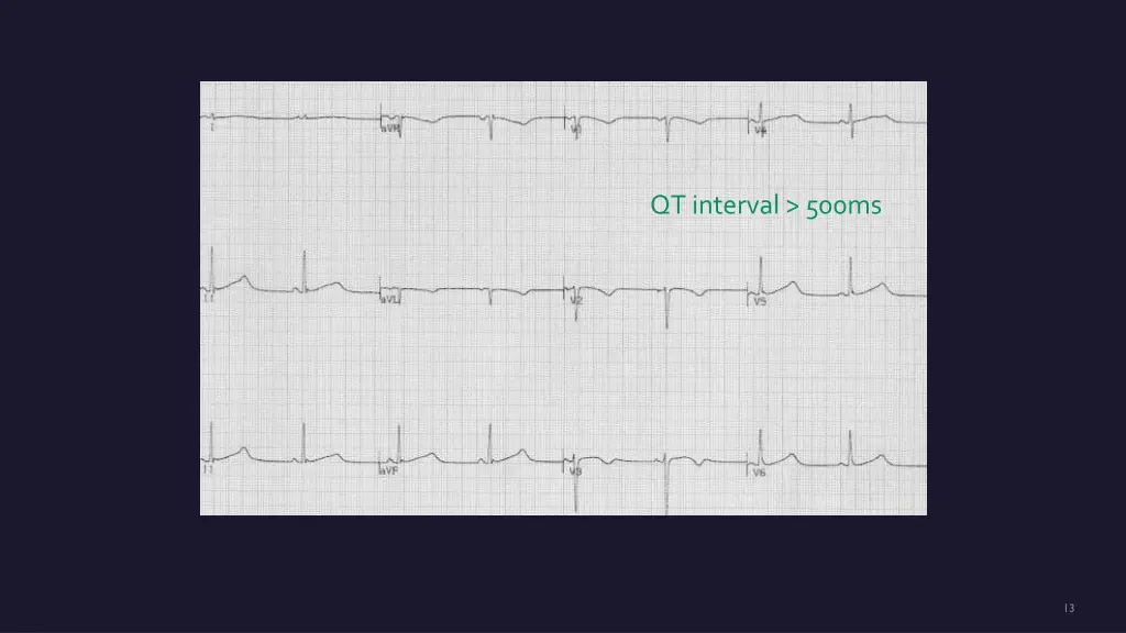 qt interval 500ms