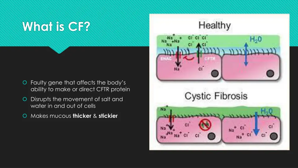 what is cf 1