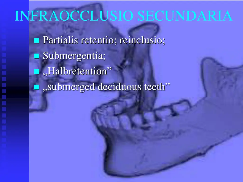 infraocclusio secundaria