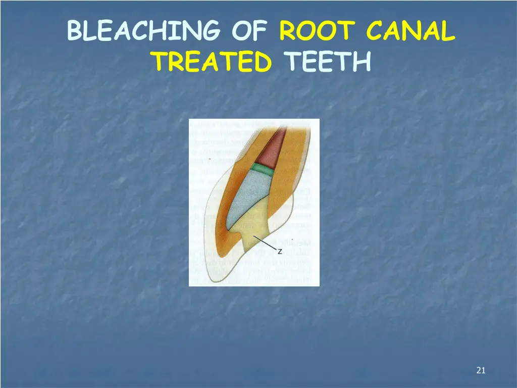 bleaching of root canal treated teeth