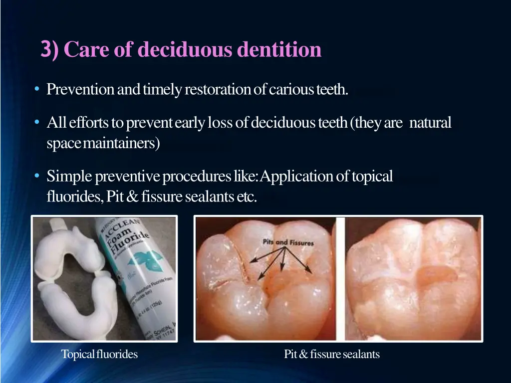 3 care of deciduousdentition