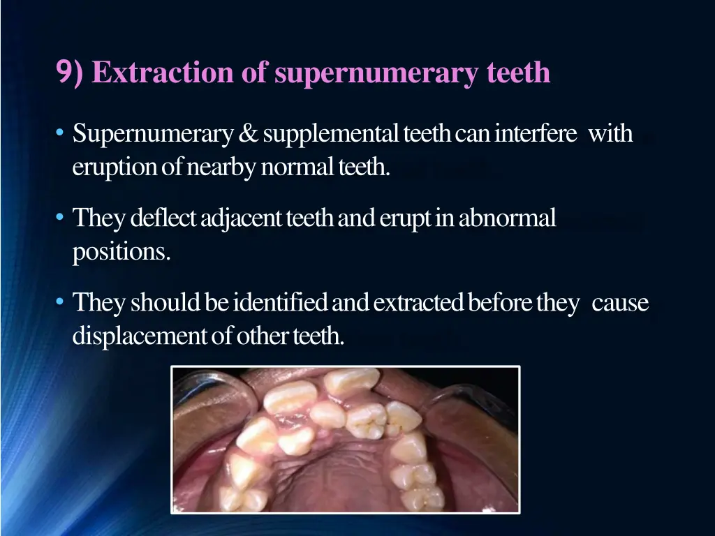 9 extraction of supernumerary teeth