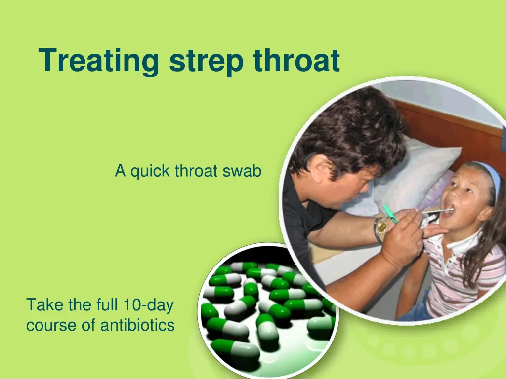 treating strep throat