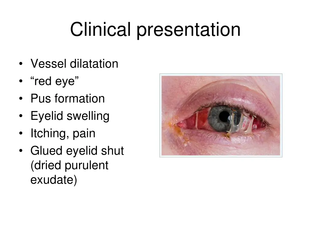 clinical presentation