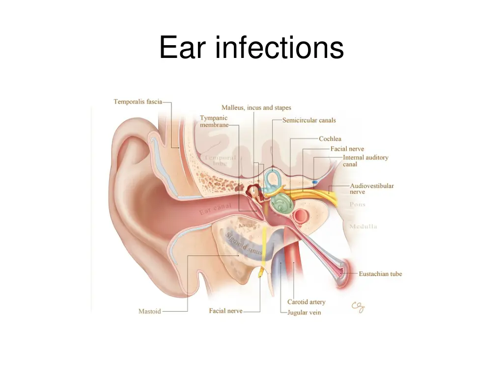 ear infections