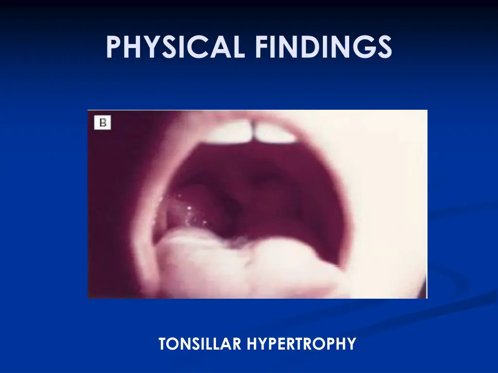 physical findings 1