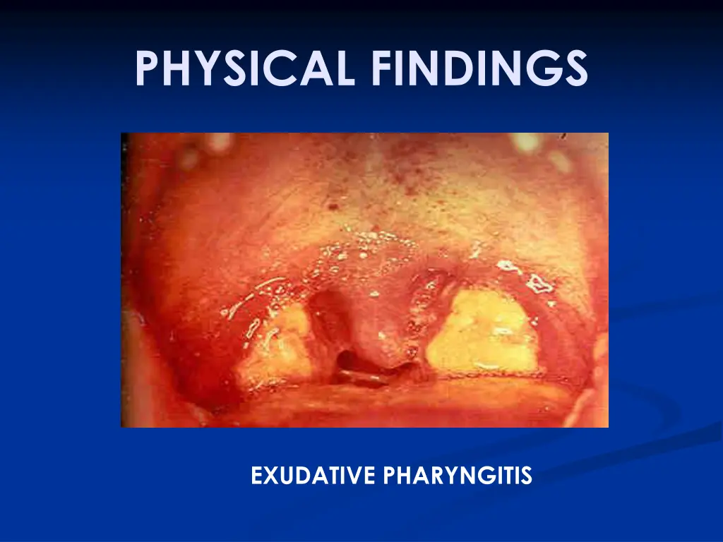 physical findings