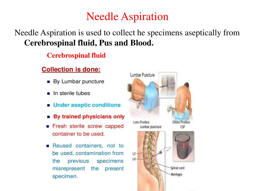 needle aspiration