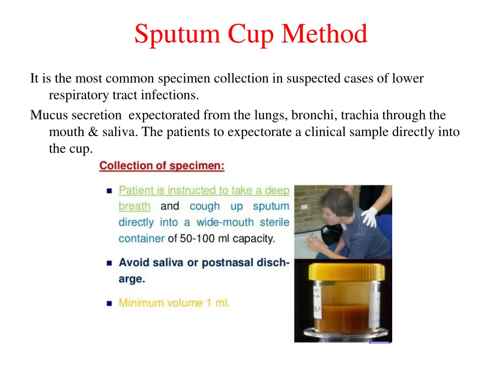 sputum cup method