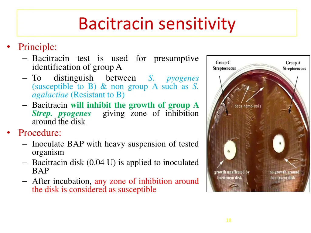 bacitracin sensitivity