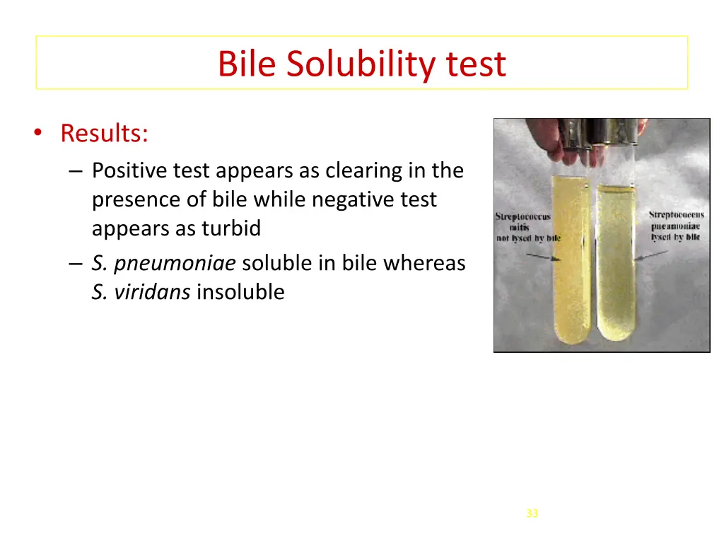 bile solubility test 1