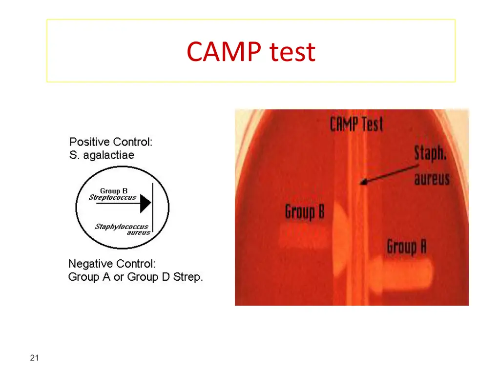 camp test 1