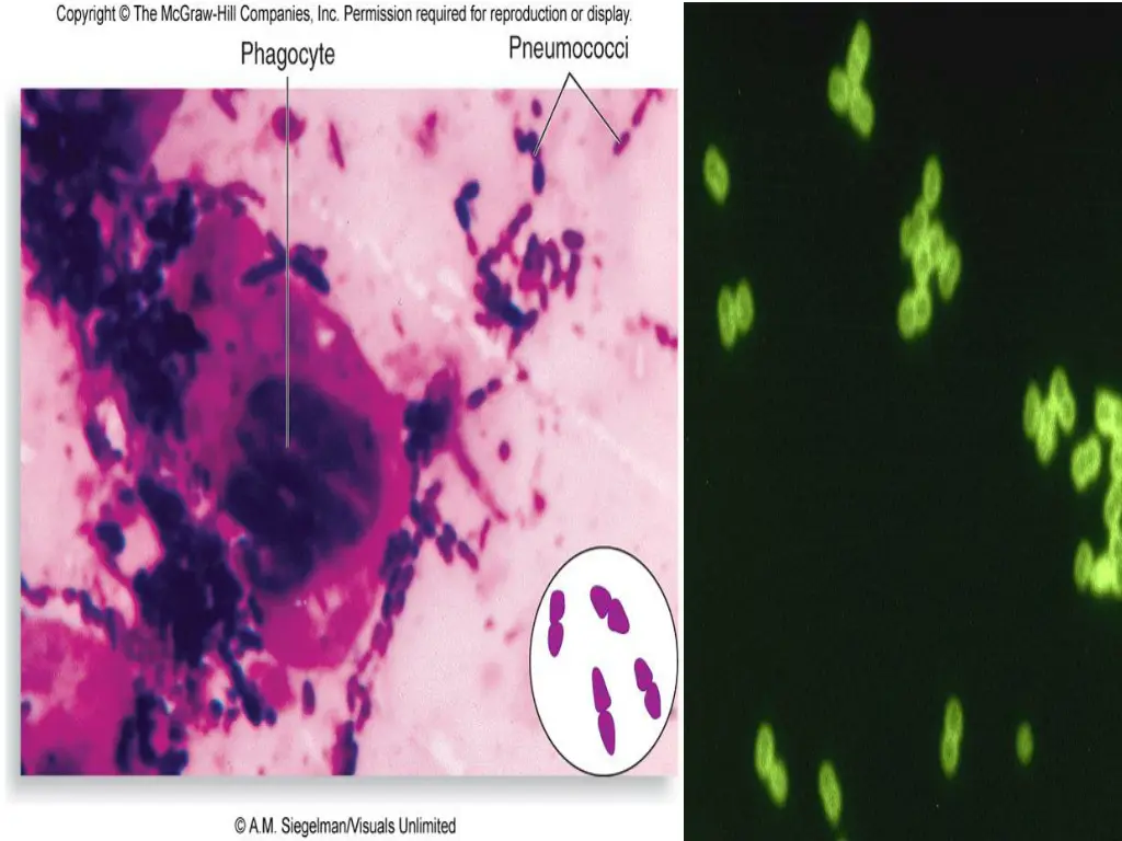 diagnosing streptococcus pneumoniae