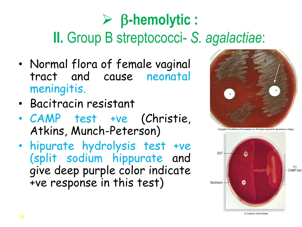 hemolytic ii group b streptococci s agalactiae