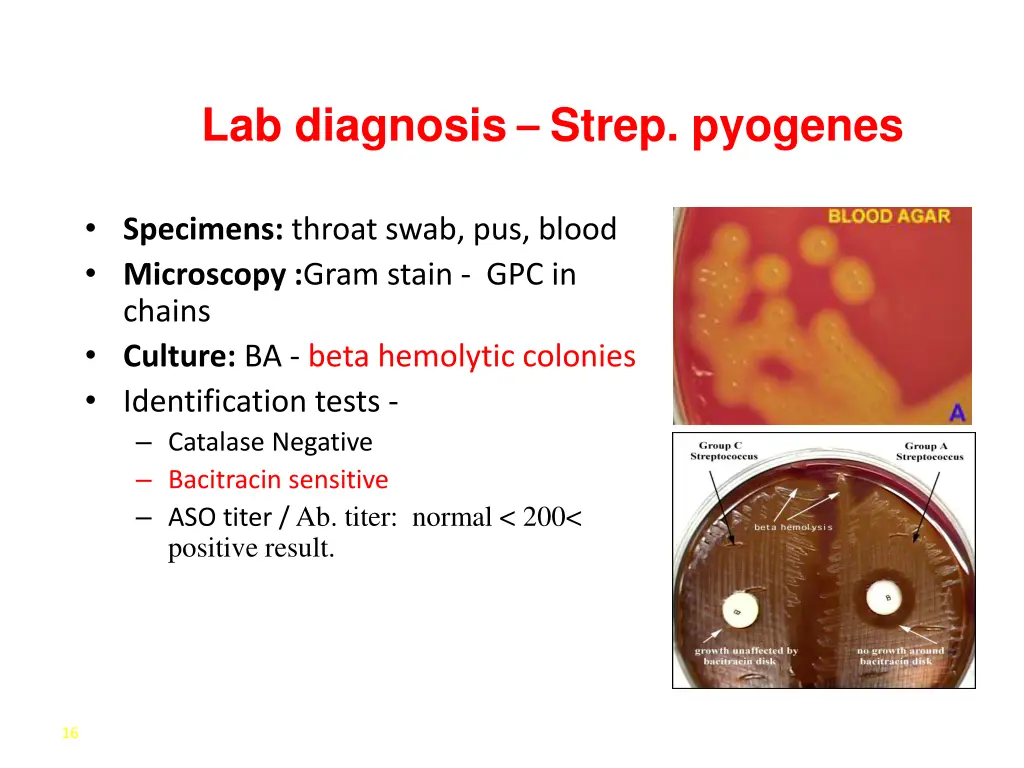 lab diagnosis strep pyogenes