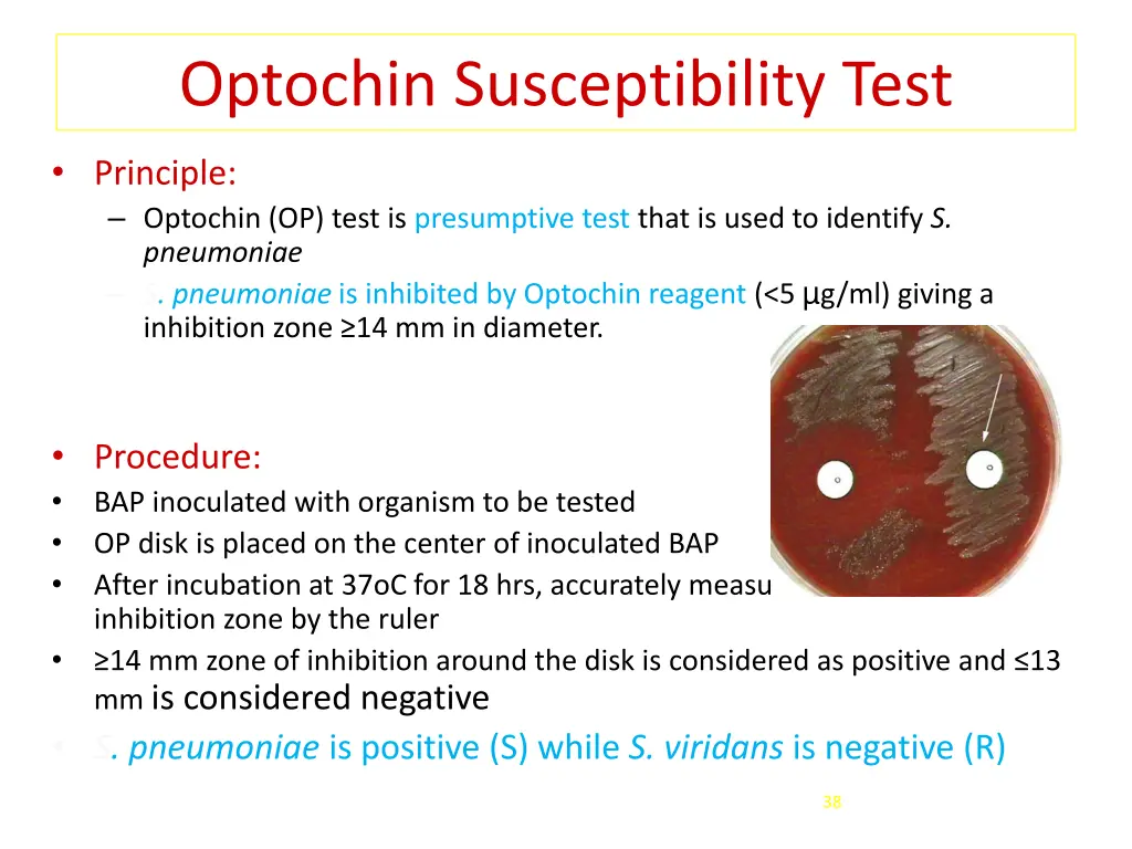 optochin susceptibility test