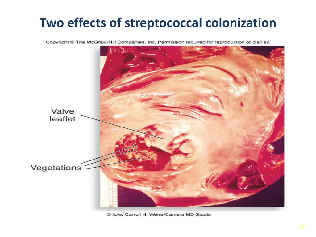 two effects of streptococcal colonization