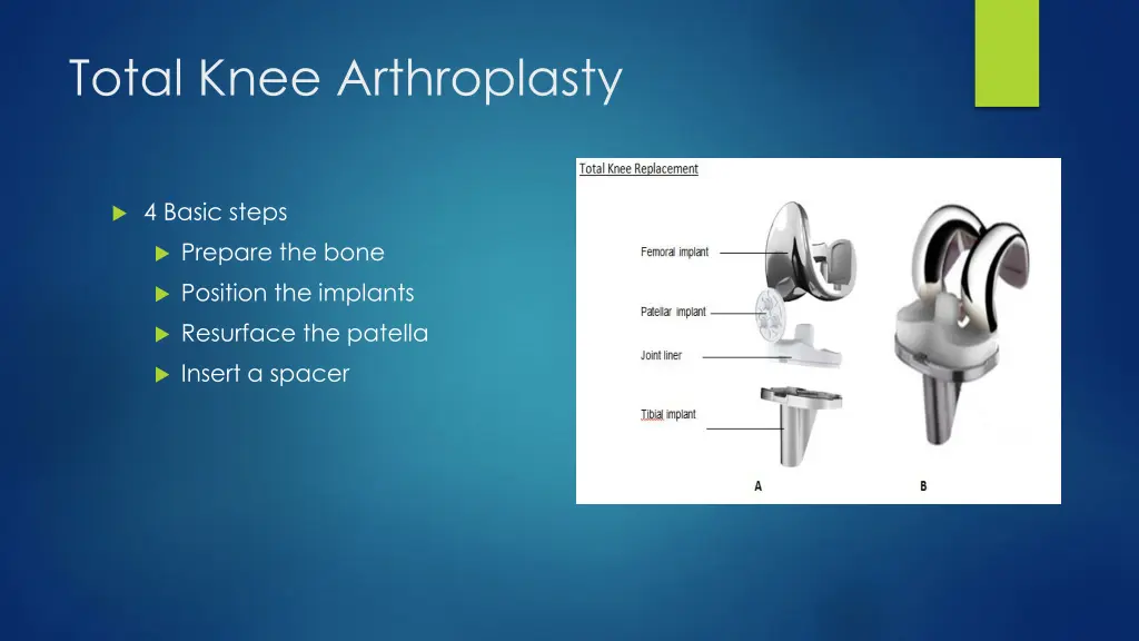 total knee arthroplasty 1