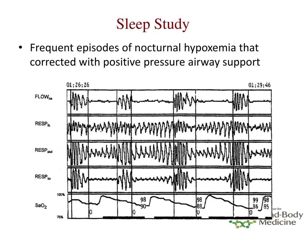 sleep study