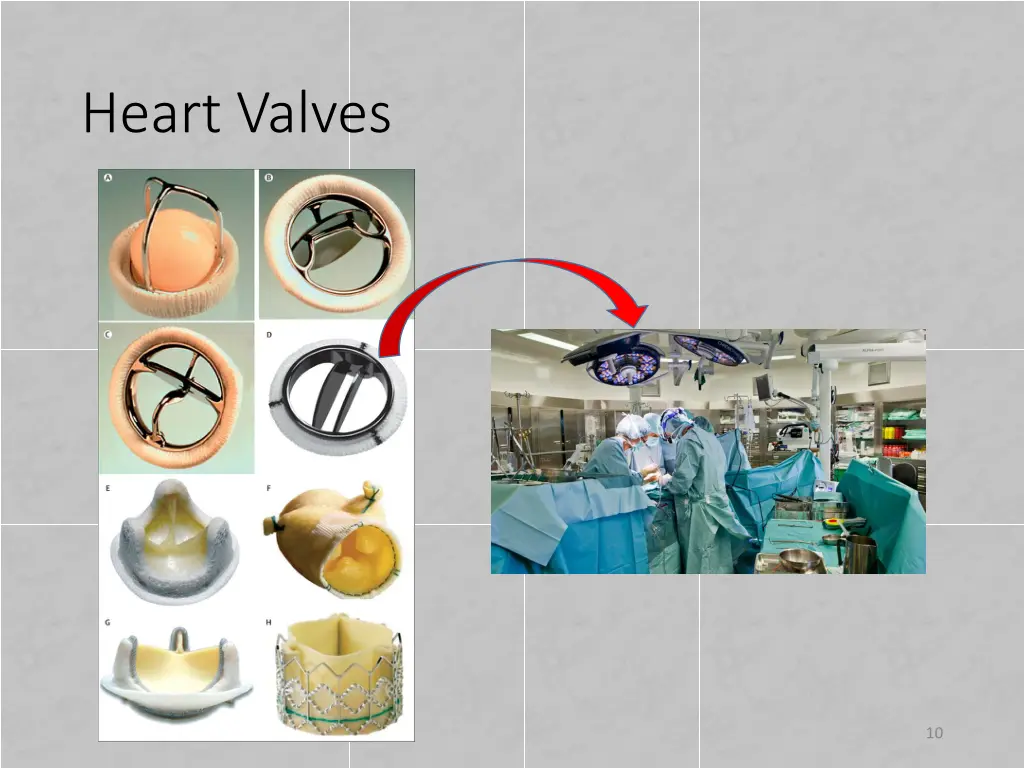 heart valves