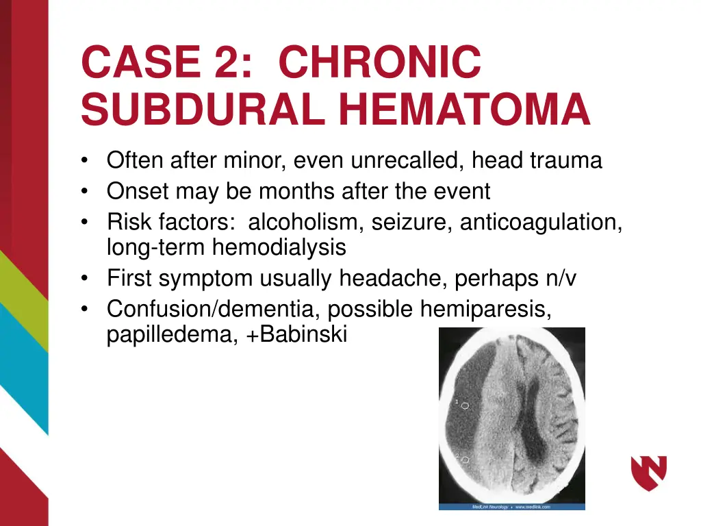 case 2 chronic subdural hematoma often after