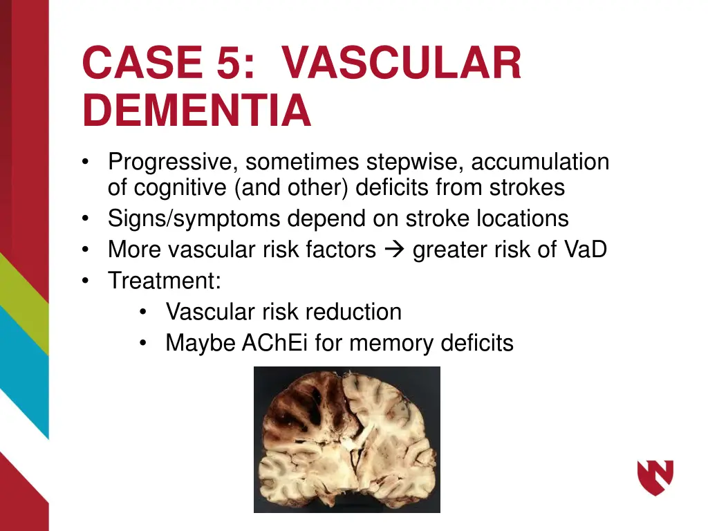 case 5 vascular dementia progressive sometimes