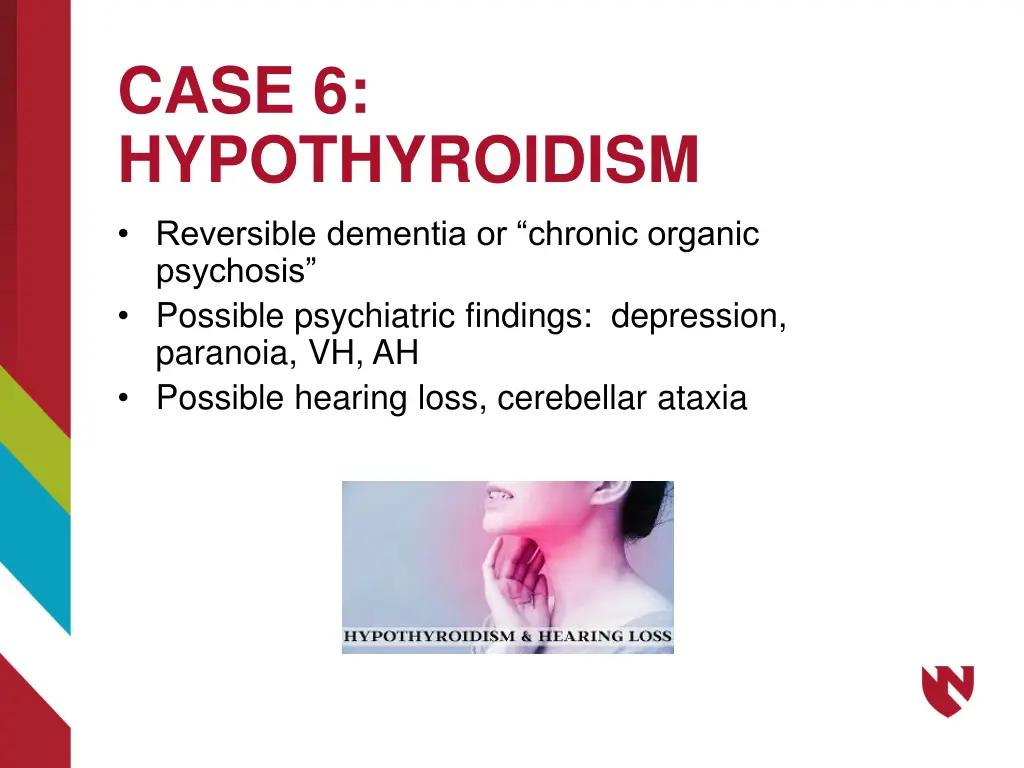 case 6 hypothyroidism