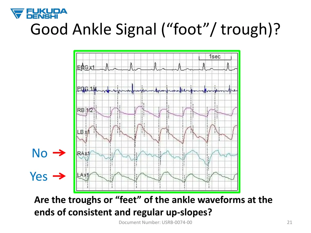 good ankle signal foot trough