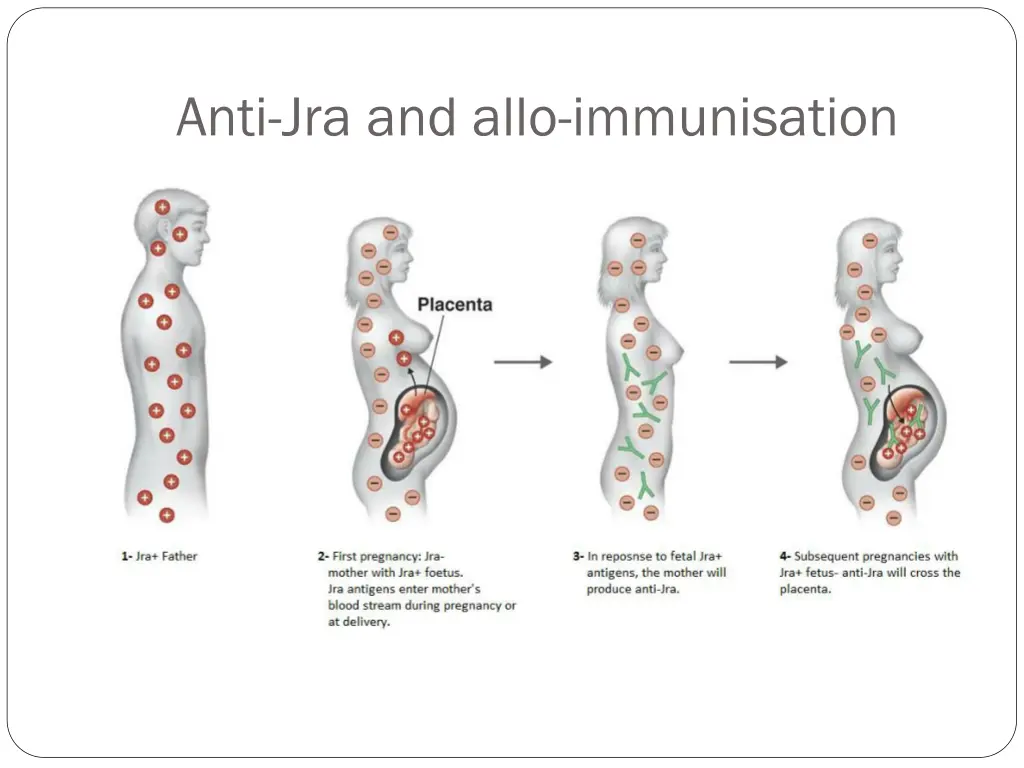 anti jra and allo immunisation