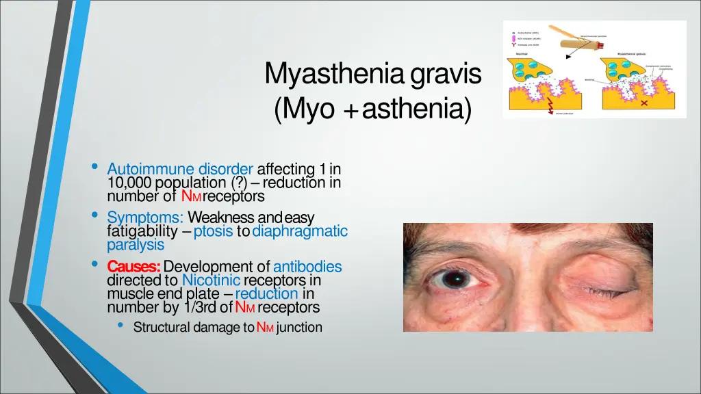 myastheniagravis myo asthenia