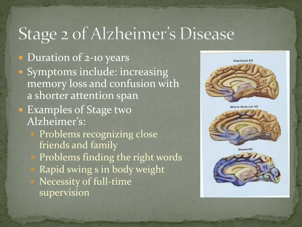 stage 2 of alzheimer s disease