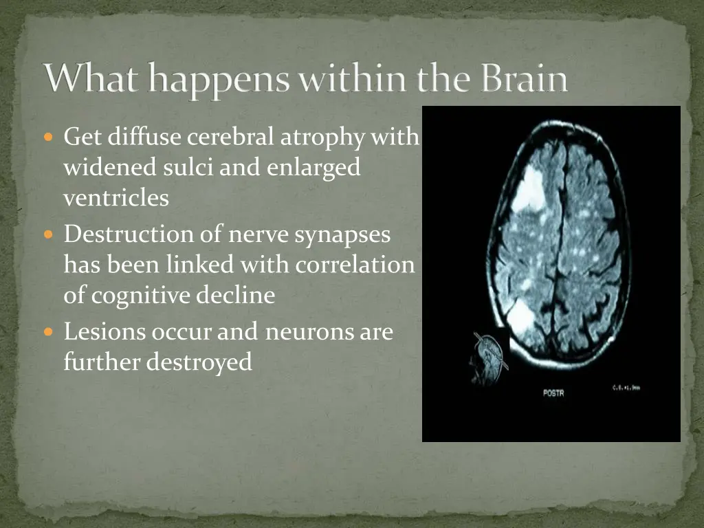 what happens within the brain