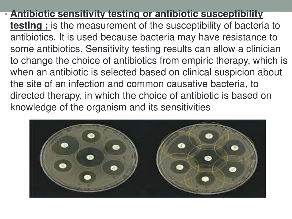 antibiotic sensitivity testing or antibiotic